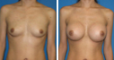 Before & After Photos